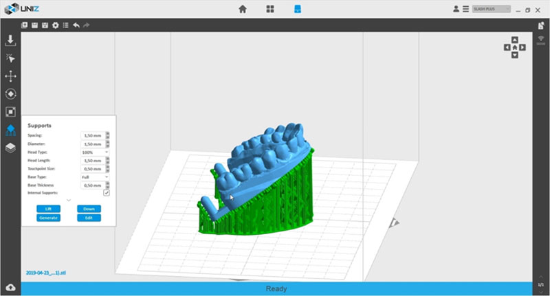 Применение 3D-принтера в стоматологии
