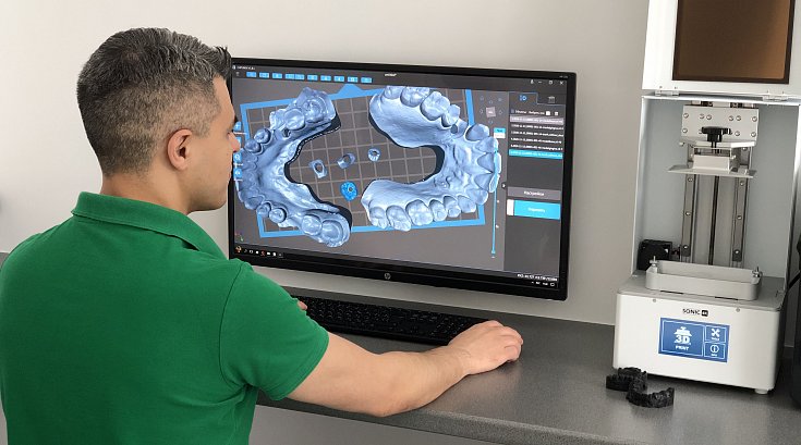 Цифровые инновации в стоматологии сегодня, или как THE ICE dental clinic применяет 3D-печать