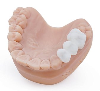 Фотополимерная смола HARZ Labs Dental Bleach, белый (500 гр)
